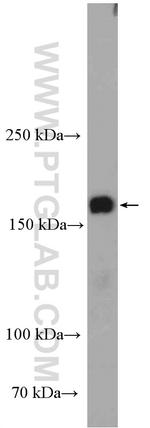 NAIP Antibody in Western Blot (WB)