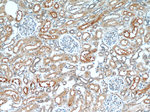 LNPEP Antibody in Immunohistochemistry (Paraffin) (IHC (P))