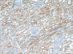 LNPEP Antibody in Immunohistochemistry (Paraffin) (IHC (P))