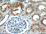 LNPEP Antibody in Immunohistochemistry (Paraffin) (IHC (P))