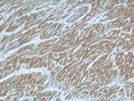LNPEP Antibody in Immunohistochemistry (Paraffin) (IHC (P))