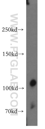 LNPEP Antibody in Western Blot (WB)