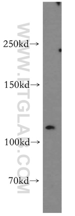 LNPEP Antibody in Western Blot (WB)
