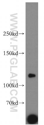 LNPEP Antibody in Western Blot (WB)