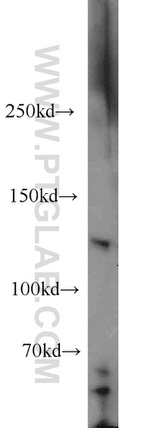 LNPEP Antibody in Western Blot (WB)