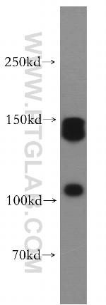 XDH Antibody in Western Blot (WB)