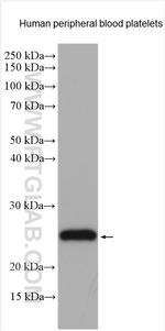 CD42c Antibody in Western Blot (WB)
