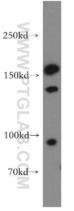 CD11d/Integrin alpha D Antibody in Western Blot (WB)