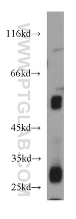 PPP3CC Antibody in Western Blot (WB)