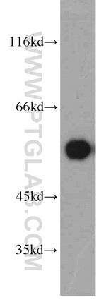 PPP3CC Antibody in Western Blot (WB)