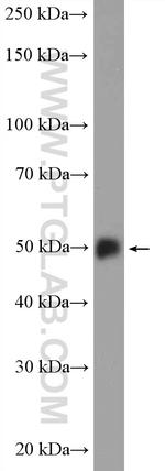 PPP3CC Antibody in Western Blot (WB)