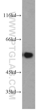 PPP3CC Antibody in Western Blot (WB)