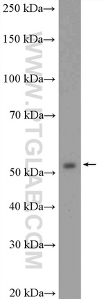 PPP3CC Antibody in Western Blot (WB)
