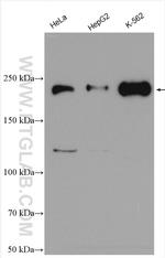 ARHGAP5 Antibody in Western Blot (WB)
