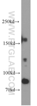 ARHGAP5 Antibody in Western Blot (WB)