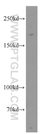 ARHGAP5 Antibody in Western Blot (WB)