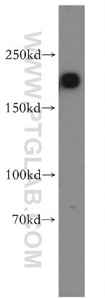 ARHGAP5 Antibody in Western Blot (WB)