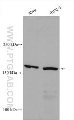 SUR1 Antibody in Western Blot (WB)