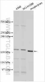 SUR1 Antibody in Western Blot (WB)