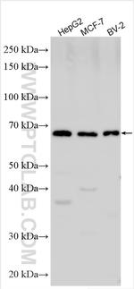 SLCO2B1 Antibody in Western Blot (WB)