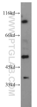 PDE6C Antibody in Western Blot (WB)