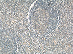 WNT5A/B Antibody in Immunohistochemistry (Paraffin) (IHC (P))
