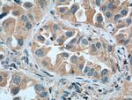 WNT5A/B Antibody in Immunohistochemistry (Paraffin) (IHC (P))