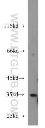 DARC Antibody in Western Blot (WB)