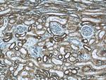 ATP1A1 Antibody in Immunohistochemistry (Paraffin) (IHC (P))