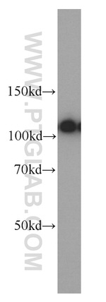 ATP1A1 Antibody in Western Blot (WB)