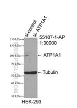 ATP1A1 Antibody in Western Blot (WB)