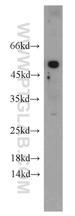 ATGL Antibody in Western Blot (WB)