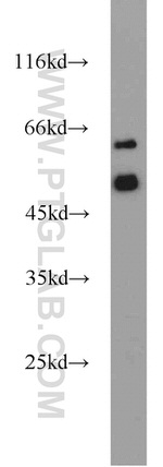 ATGL Antibody in Western Blot (WB)
