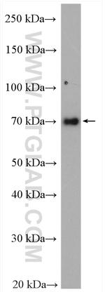 EWS Antibody in Western Blot (WB)