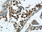CPSF7 Antibody in Immunohistochemistry (Paraffin) (IHC (P))