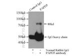 PAPD5 Antibody in Immunoprecipitation (IP)