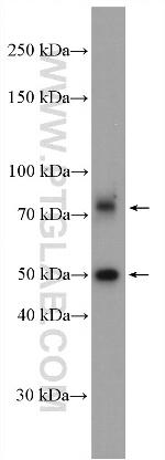PAPD5 Antibody in Western Blot (WB)