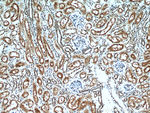 SET Antibody in Immunohistochemistry (Paraffin) (IHC (P))