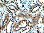 SET Antibody in Immunohistochemistry (Paraffin) (IHC (P))