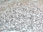 SET Antibody in Immunohistochemistry (Paraffin) (IHC (P))
