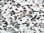 SET Antibody in Immunohistochemistry (Paraffin) (IHC (P))