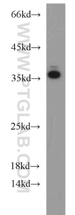 SET Antibody in Western Blot (WB)