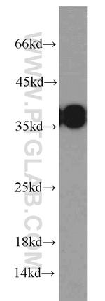 SET Antibody in Western Blot (WB)