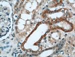 OXER1 Antibody in Immunohistochemistry (Paraffin) (IHC (P))