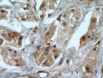 IGFBP5 Antibody in Immunohistochemistry (Paraffin) (IHC (P))