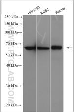 L-Plastin Antibody in Western Blot (WB)