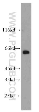 L-Plastin Antibody in Western Blot (WB)