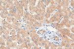 ACADM Antibody in Immunohistochemistry (Paraffin) (IHC (P))