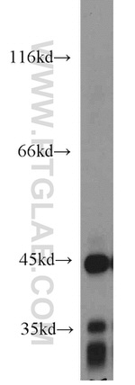 ACADM Antibody in Western Blot (WB)