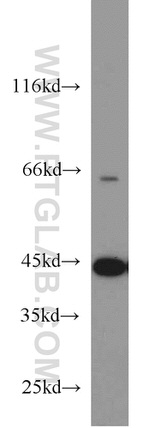 ACADM Antibody in Western Blot (WB)
